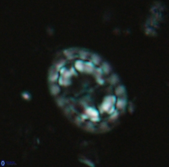 Prediscosphaera arkhangelskyi 4970