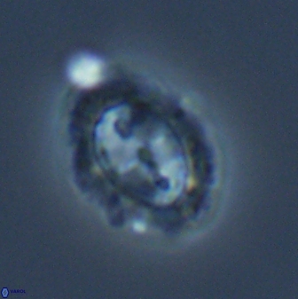 Prediscosphaera arkhangelskyi 16069