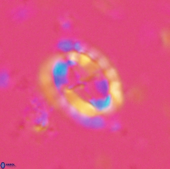 Prediscosphaera arkhangelskyi 16107