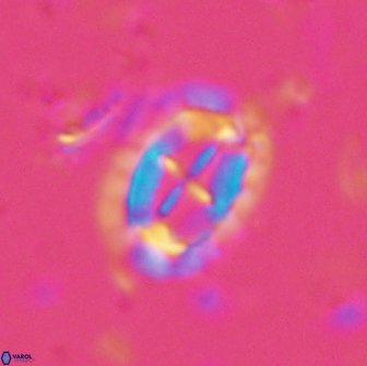 Prediscosphaera arkhangelskyi 16110