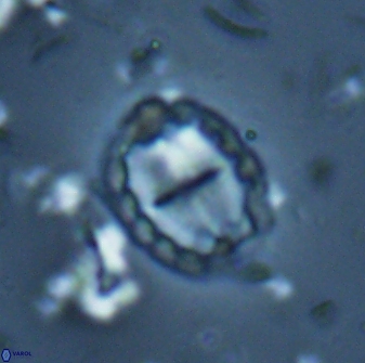 Prediscosphaera arkhangelskyi 16117
