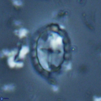 Prediscosphaera arkhangelskyi 16116