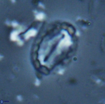 Prediscosphaera arkhangelskyi 16118
