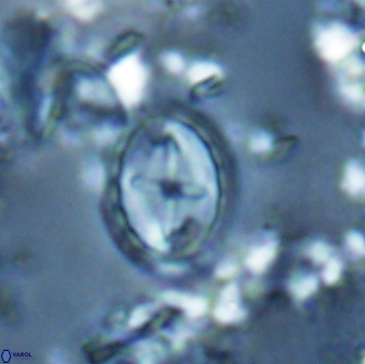 Prediscosphaera arkhangelskyi 16227