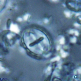Prediscosphaera arkhangelskyi 16228