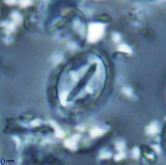 Prediscosphaera arkhangelskyi 16229