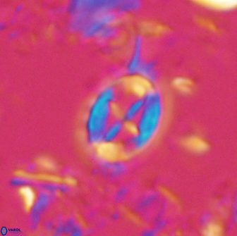 Prediscosphaera arkhangelskyi 16236