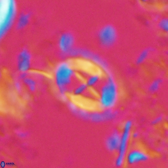 Prediscosphaera arkhangelskyi 16238
