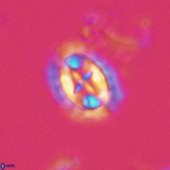 Prediscosphaera arkhangelskyi 16377