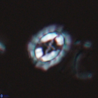 Prediscosphaera arkhangelskyi 16378