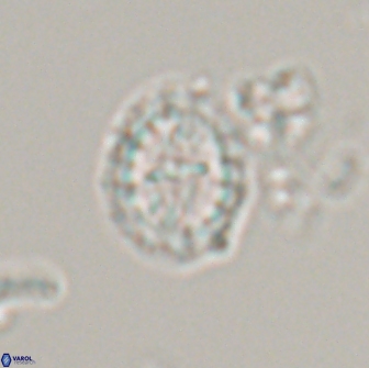 Prediscosphaera arkhangelskyi 16380