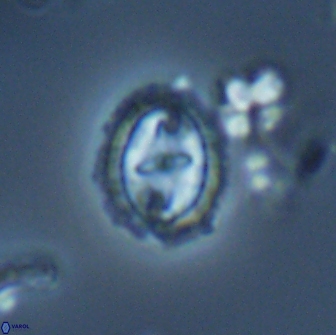 Prediscosphaera arkhangelskyi 16381