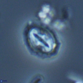 Prediscosphaera arkhangelskyi 16386
