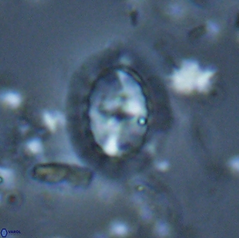 Prediscosphaera arkhangelskyi 16302