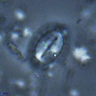 Prediscosphaera arkhangelskyi 16304