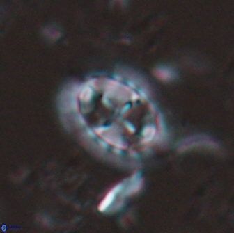 Prediscosphaera arkhangelskyi 16309