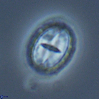 Prediscosphaera arkhangelskyi 16718