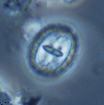 Prediscosphaera arkhangelskyi 18121