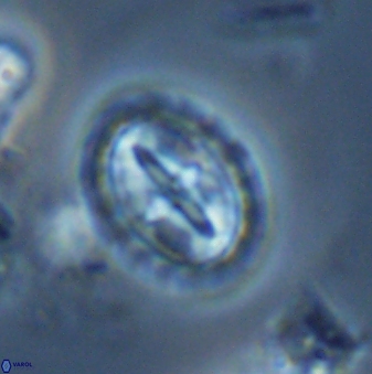 Prediscosphaera arkhangelskyi 18122
