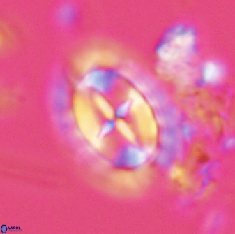 Prediscosphaera arkhangelskyi 28771