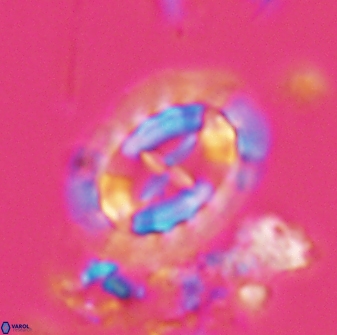 Prediscosphaera arkhangelskyi 28773