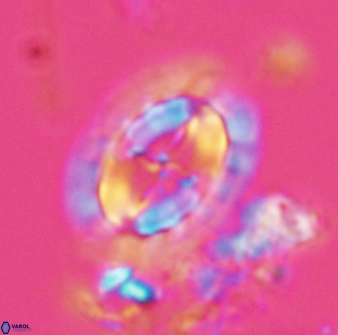 Prediscosphaera arkhangelskyi 28775