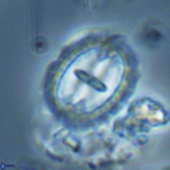 Prediscosphaera arkhangelskyi 28778