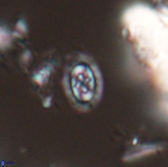 Prediscosphaera borealensis 28732