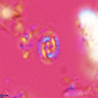 Prediscosphaera borealensis 28735