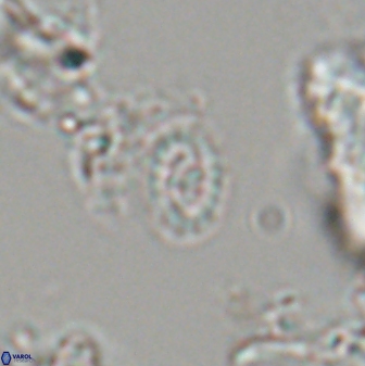 Prediscosphaera borealensis 28743