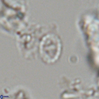 Prediscosphaera borealensis 28744