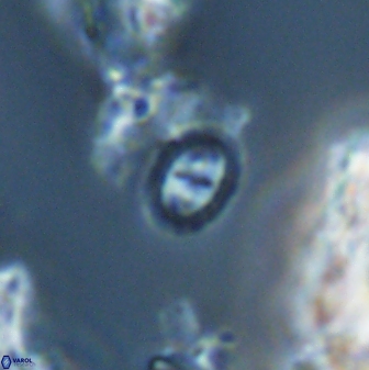 Prediscosphaera borealensis 28745