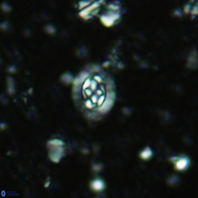 Prediscosphaera germanica 4510