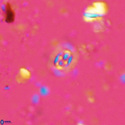 Prediscosphaera germanica 4513