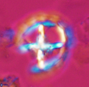 Prediscosphaera grandis 10164