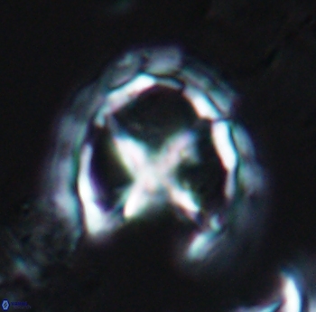 Prediscosphaera grandis 10165