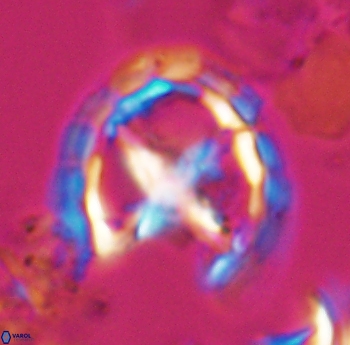 Prediscosphaera grandis 10166