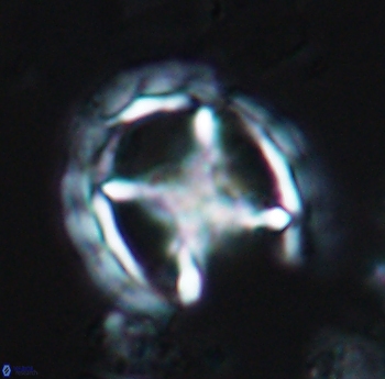 Prediscosphaera grandis 10167