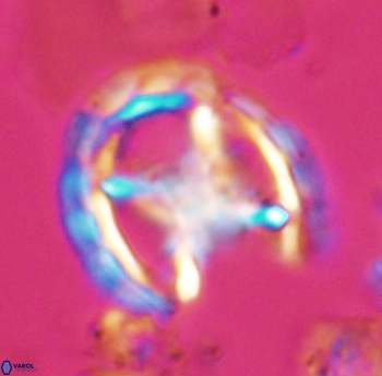 Prediscosphaera grandis 10169