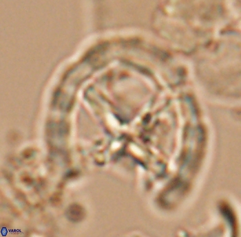 Prediscosphaera grandis 10170