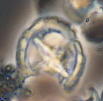 Prediscosphaera grandis 10171