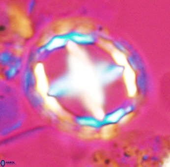Prediscosphaera grandis 10123