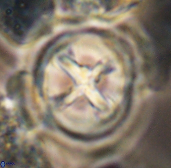 Prediscosphaera grandis 10132