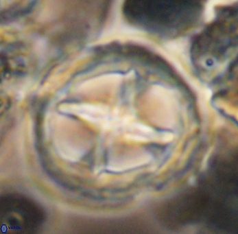 Prediscosphaera grandis 10133