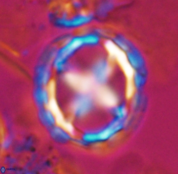 Prediscosphaera grandis 10316