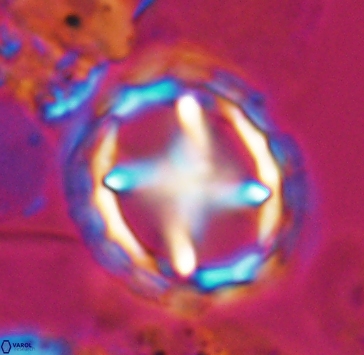 Prediscosphaera grandis 10317
