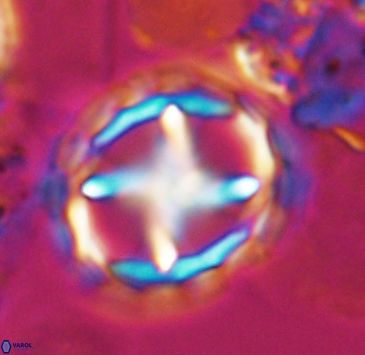 Prediscosphaera grandis 10321