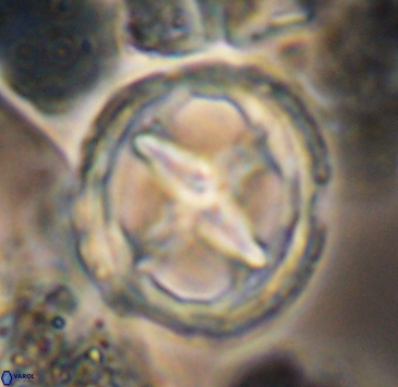 Prediscosphaera grandis 10322