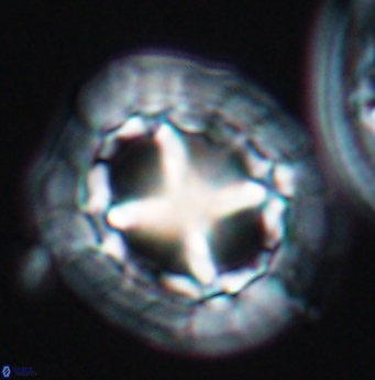 Prediscosphaera grandis 11929