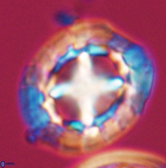 Prediscosphaera grandis 11934